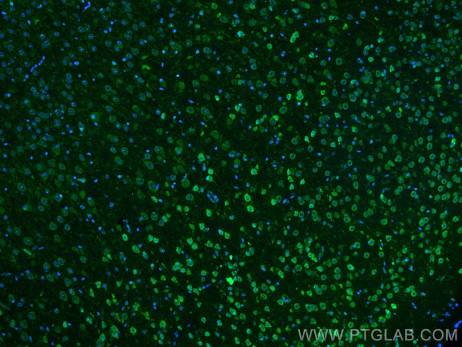 S1PR2 Antibody in Immunohistochemistry (Paraffin) (IHC (P))