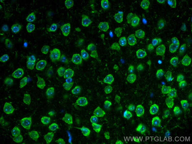 S1PR2 Antibody in Immunohistochemistry (Paraffin) (IHC (P))