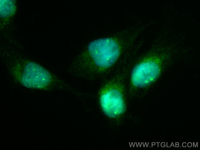 NFATC2 Antibody in Immunocytochemistry (ICC/IF)