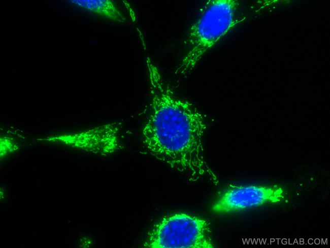 C1QBP Antibody in Immunocytochemistry (ICC/IF)