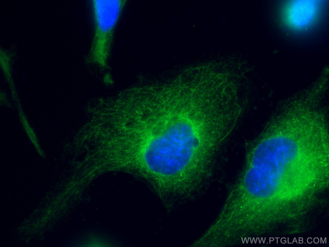 pan-keratin Antibody in Immunocytochemistry (ICC/IF)