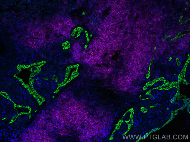 pan-keratin Antibody in Immunohistochemistry (Paraffin) (IHC (P))