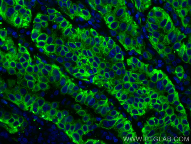 pan-keratin Antibody in Immunohistochemistry (Paraffin) (IHC (P))