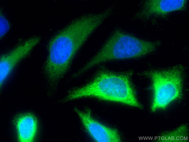 NDRG1 Antibody in Immunocytochemistry (ICC/IF)