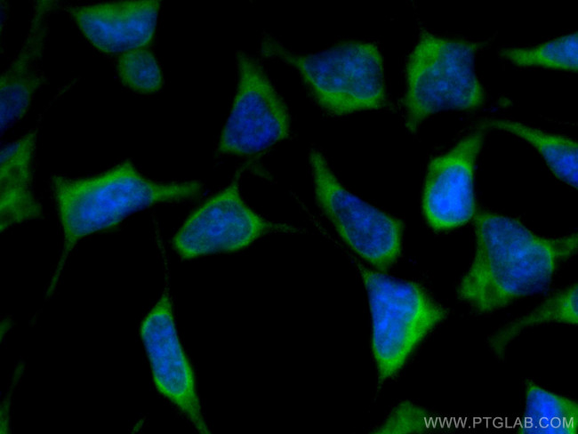 CITED1 Antibody in Immunocytochemistry (ICC/IF)