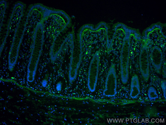 TGFBI/BIGH3 Antibody in Immunohistochemistry (Paraffin) (IHC (P))