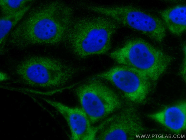 LGALS3BP Antibody in Immunocytochemistry (ICC/IF)