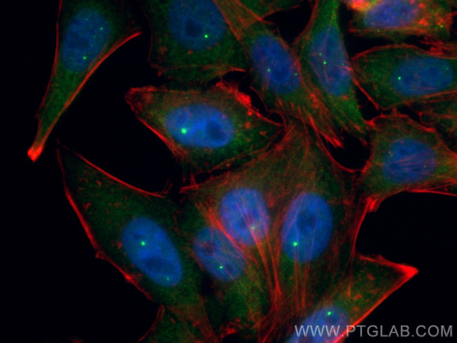 SMN Antibody in Immunocytochemistry (ICC/IF)