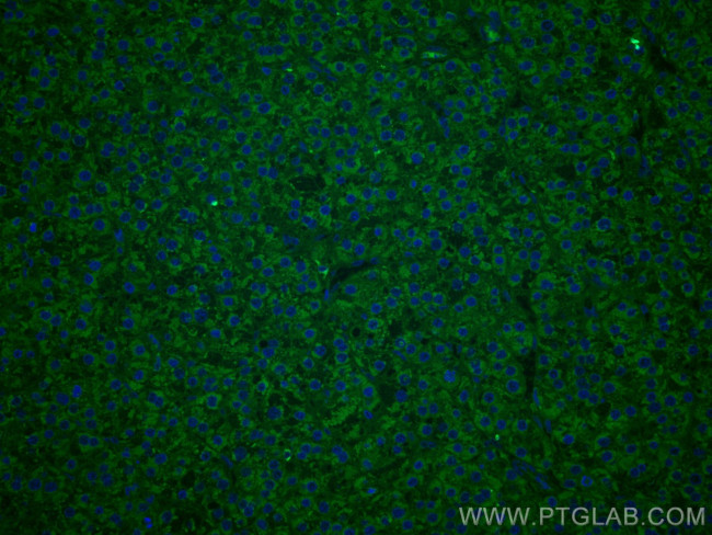 TNFR1 Antibody in Immunohistochemistry (Paraffin) (IHC (P))