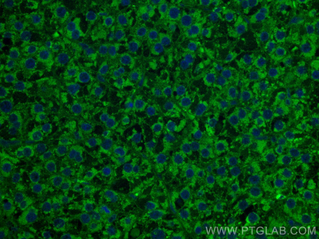 TNFR1 Antibody in Immunohistochemistry (Paraffin) (IHC (P))