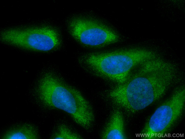 Galectin-1 Antibody in Immunocytochemistry (ICC/IF)