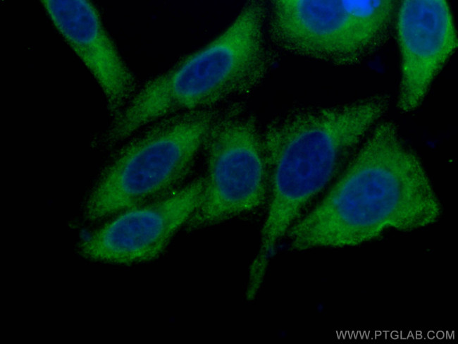 SND1 Antibody in Immunocytochemistry (ICC/IF)