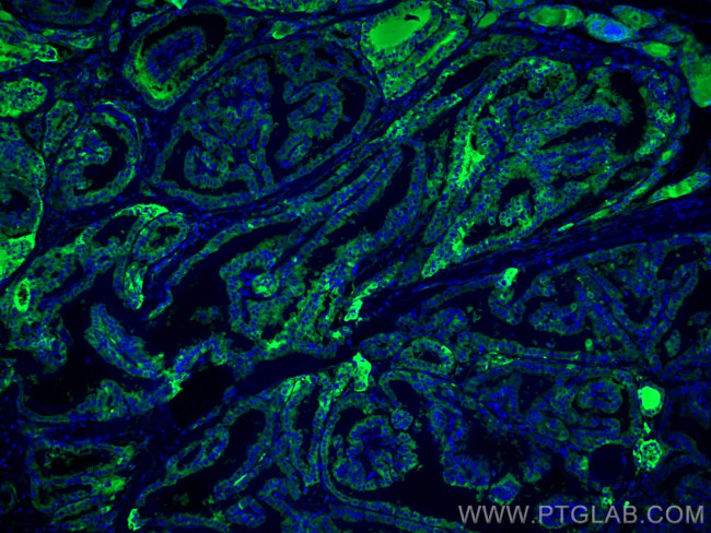 Thyroglobulin Antibody in Immunohistochemistry (Paraffin) (IHC (P))