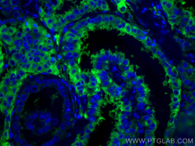 Thyroglobulin Antibody in Immunohistochemistry (Paraffin) (IHC (P))