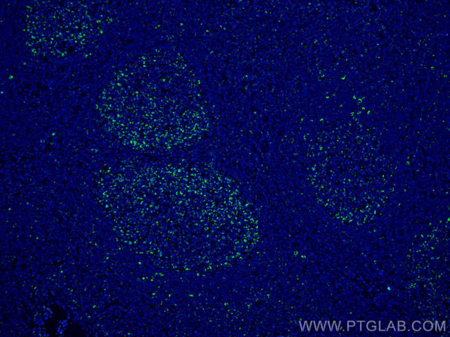 IL-19 Antibody in Immunohistochemistry (Paraffin) (IHC (P))