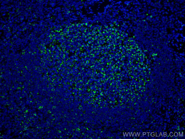 IL-19 Antibody in Immunohistochemistry (Paraffin) (IHC (P))