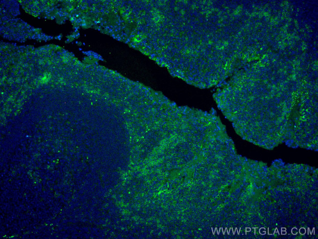 IL-2 Antibody in Immunohistochemistry (Paraffin) (IHC (P))