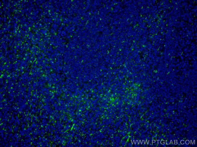 IL-2 Antibody in Immunohistochemistry (Paraffin) (IHC (P))