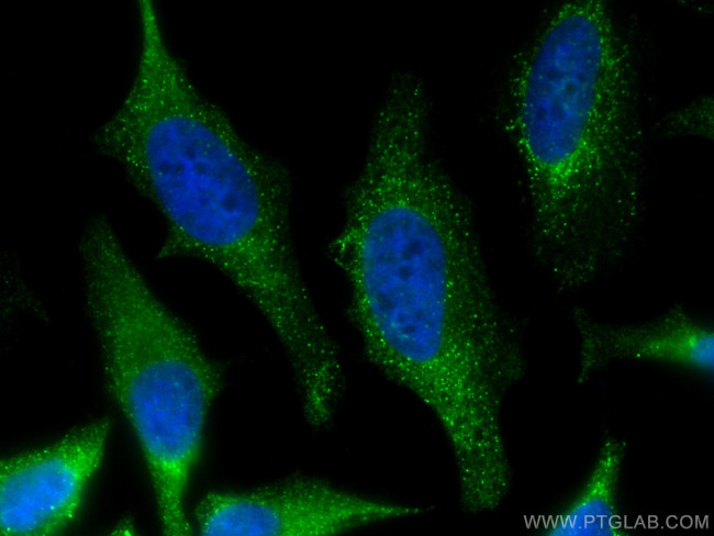 MCL1 Antibody in Immunocytochemistry (ICC/IF)