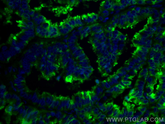 Protein C inhibitor Antibody in Immunohistochemistry (Paraffin) (IHC (P))