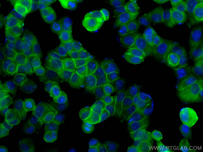 Annexin A2 Antibody in Immunocytochemistry (ICC/IF)