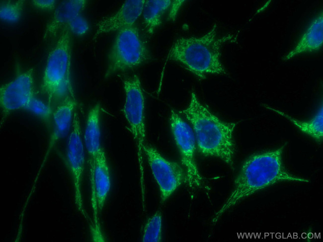 LONP1 Antibody in Immunocytochemistry (ICC/IF)