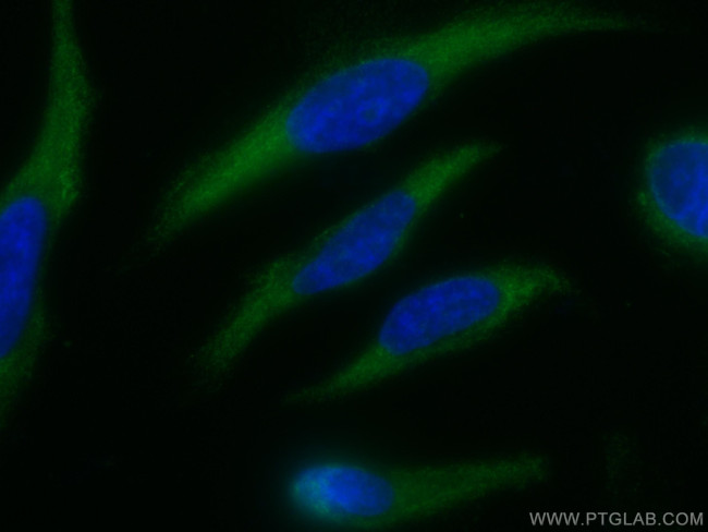 NCALD Antibody in Immunocytochemistry (ICC/IF)