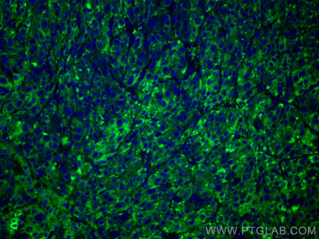 RBP4 Antibody in Immunohistochemistry (Paraffin) (IHC (P))