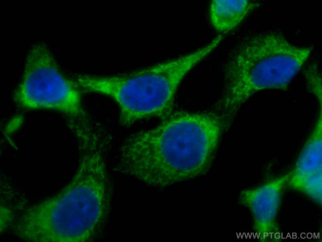 CSK Antibody in Immunocytochemistry (ICC/IF)