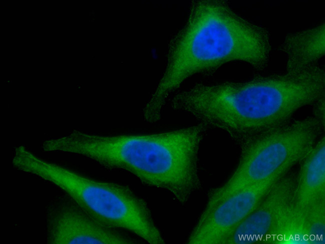 Aldolase C Antibody in Immunocytochemistry (ICC/IF)