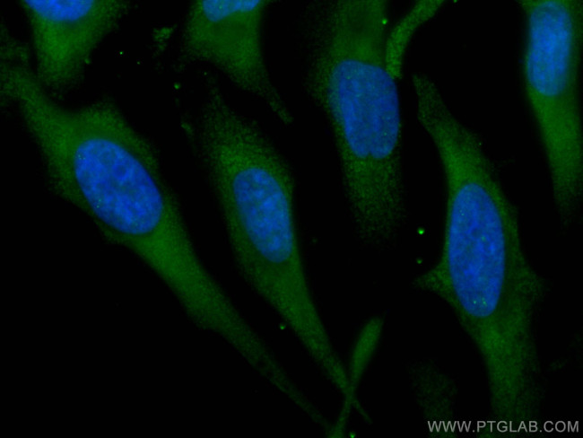 Kininogen 1 Antibody in Immunocytochemistry (ICC/IF)