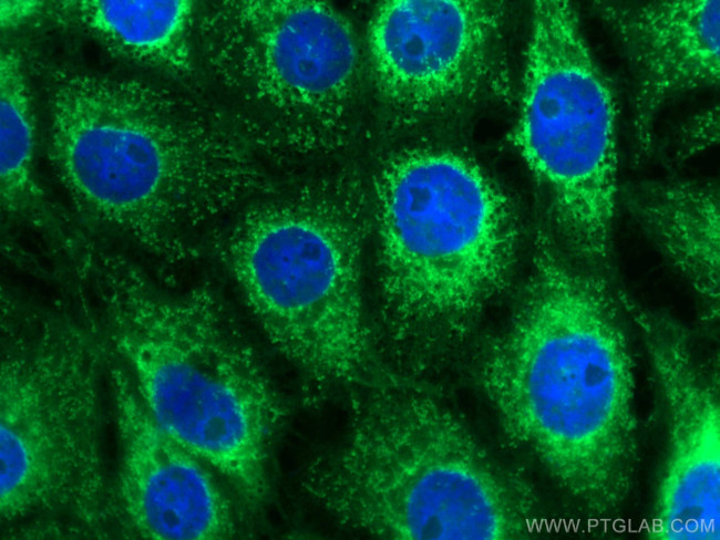 C9orf72 Antibody in Immunocytochemistry (ICC/IF)