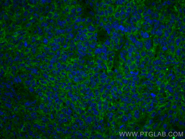 IL-9 Antibody in Immunohistochemistry (Paraffin) (IHC (P))