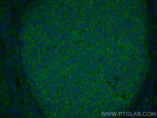 IL-9 Antibody in Immunohistochemistry (Paraffin) (IHC (P))