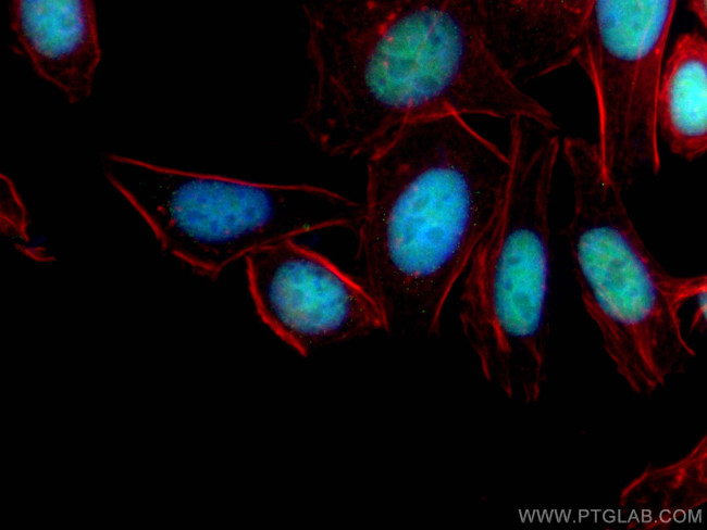 ANP32B Antibody in Immunocytochemistry (ICC/IF)