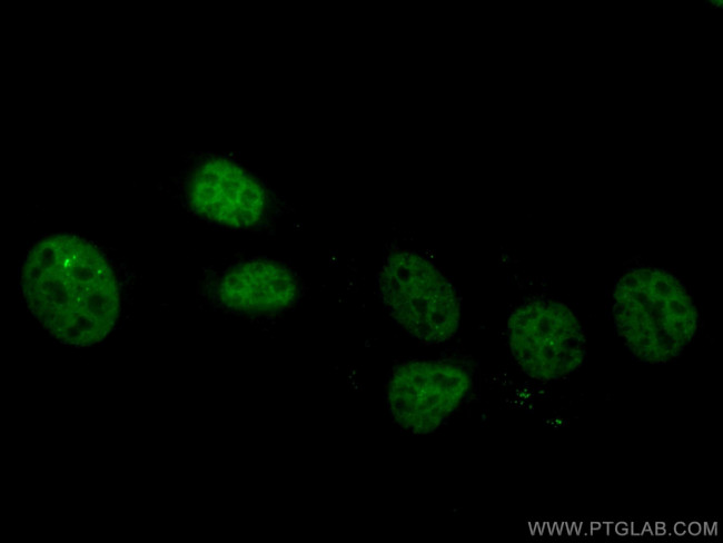 TBP Antibody in Immunocytochemistry (ICC/IF)