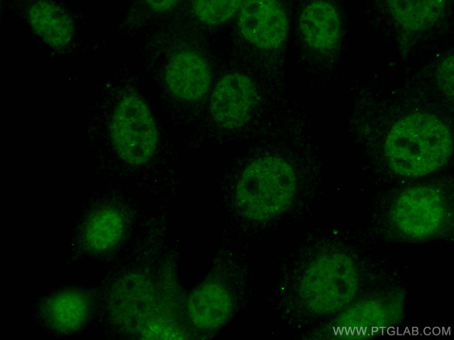 TBP Antibody in Immunocytochemistry (ICC/IF)