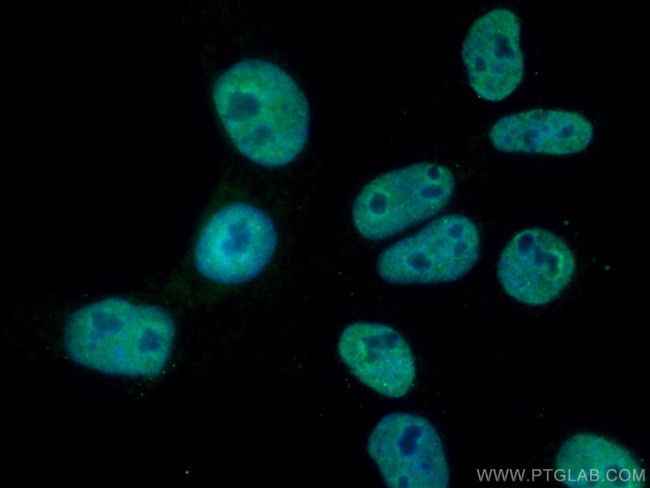 TBP Antibody in Immunocytochemistry (ICC/IF)