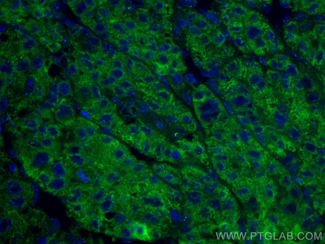 Transferrin Antibody in Immunohistochemistry (Paraffin) (IHC (P))