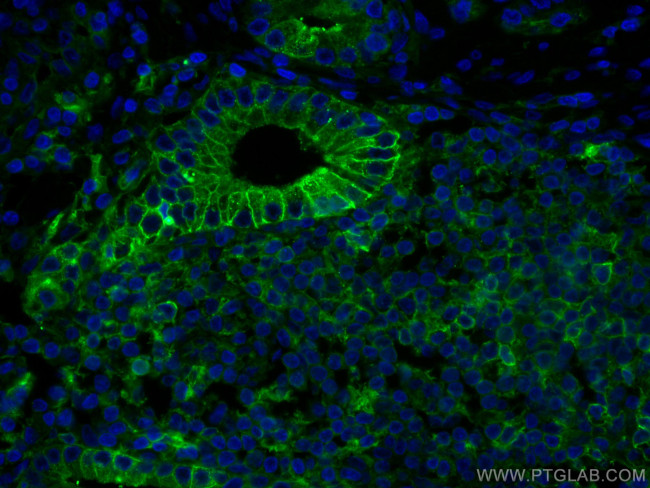 Beta-2-Microglobulin Antibody in Immunohistochemistry (Paraffin) (IHC (P))