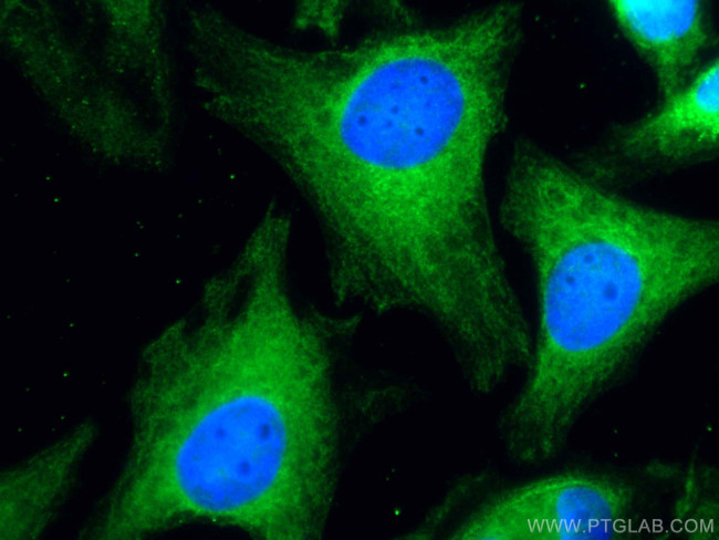 JNK Antibody in Immunocytochemistry (ICC/IF)