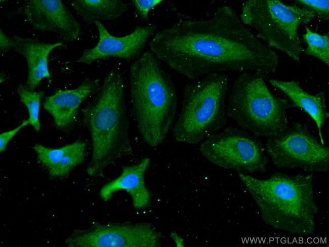 APOD Antibody in Immunocytochemistry (ICC/IF)