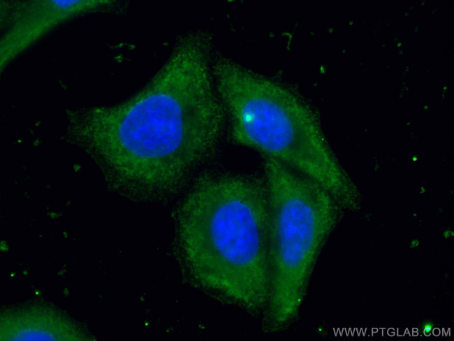 ORM2 Antibody in Immunocytochemistry (ICC/IF)