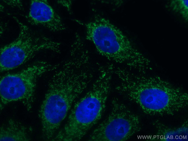 UCHL1/PGP9.5 Antibody in Immunocytochemistry (ICC/IF)