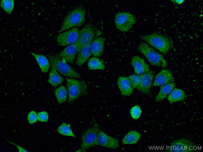 14-3-3 Sigma Antibody in Immunocytochemistry (ICC/IF)