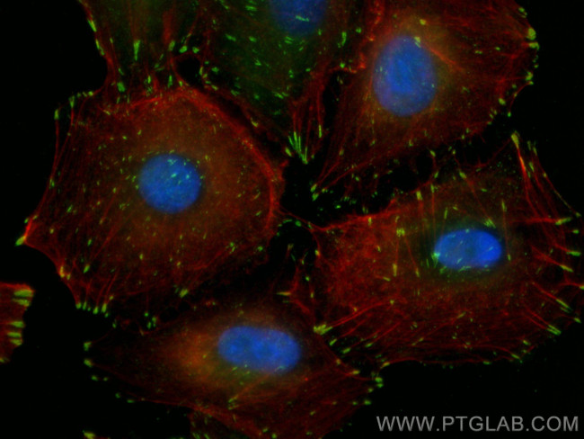 FAK Antibody in Immunocytochemistry (ICC/IF)