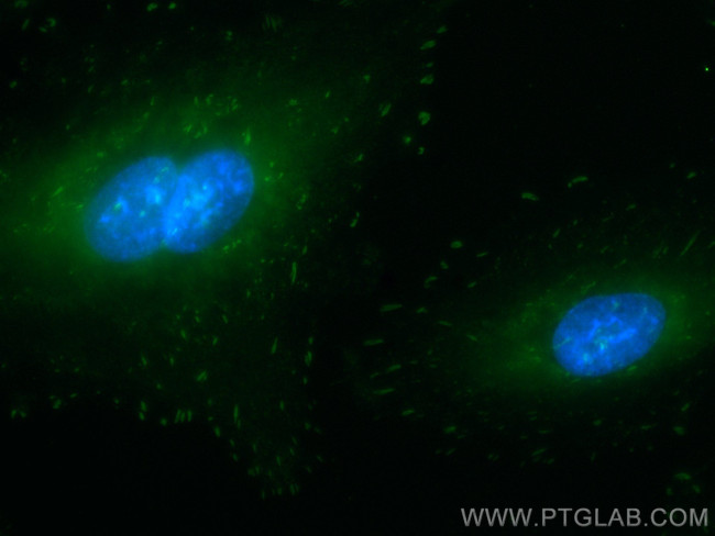 FAK Antibody in Immunocytochemistry (ICC/IF)