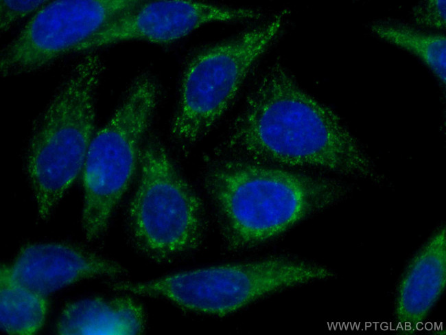 Alpha 1B-Glycoprotein Antibody in Immunocytochemistry (ICC/IF)