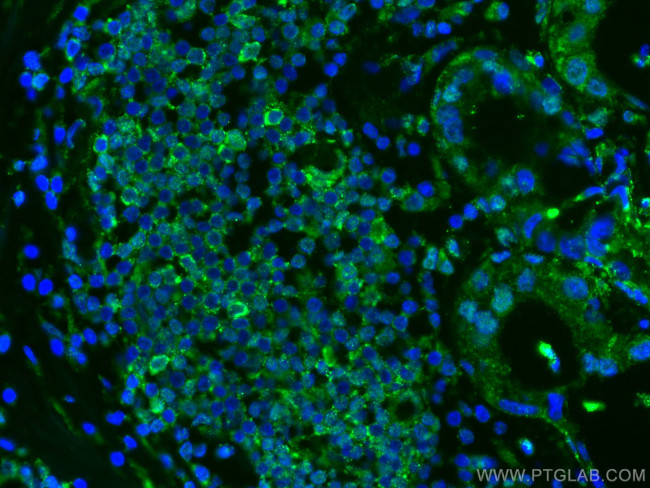 L2HGDH Antibody in Immunohistochemistry (Paraffin) (IHC (P))