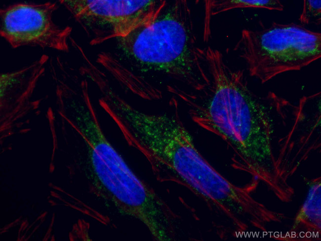 TRAF3 Antibody in Immunocytochemistry (ICC/IF)